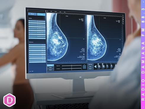 Muertes por cáncer de mama aumentan un 50% en la Región de Atacama 6 mamografia web
